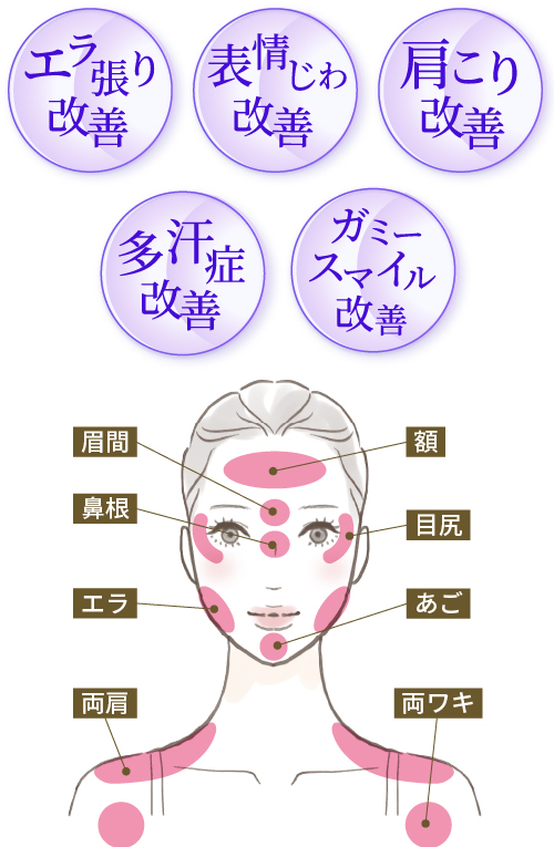 ボトックスビスタの効果