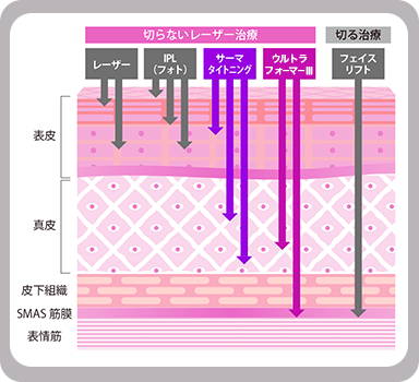 従来治療と比較！