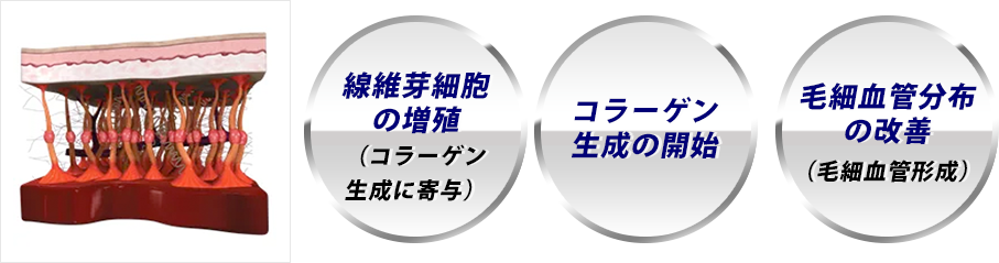 線維芽細胞の増殖（コラーゲン生成に寄与）,コラーゲン生成の開始,毛細血管分布の改善（毛細血管形成）