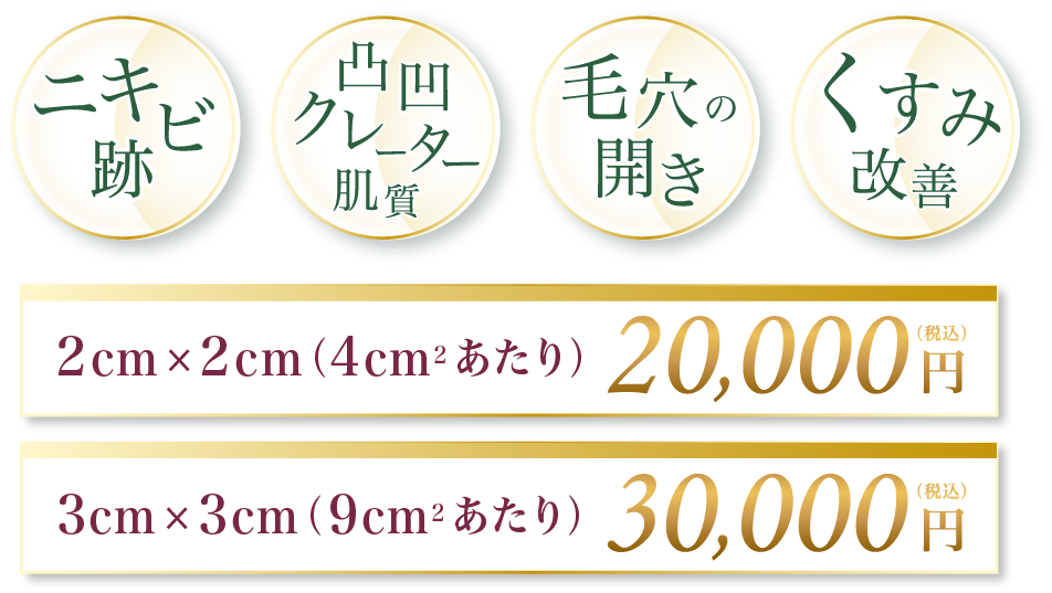 ニキビ跡 肌の凸凹・クレーター肌質 毛穴の開き くすみ改善 2cm x 2cm(4㎠あたり) 20,000円(税込)3cm x 3cm(9㎠あたり) 30,000円(税込)