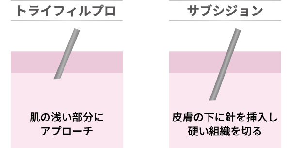 アプローチ方法の違い