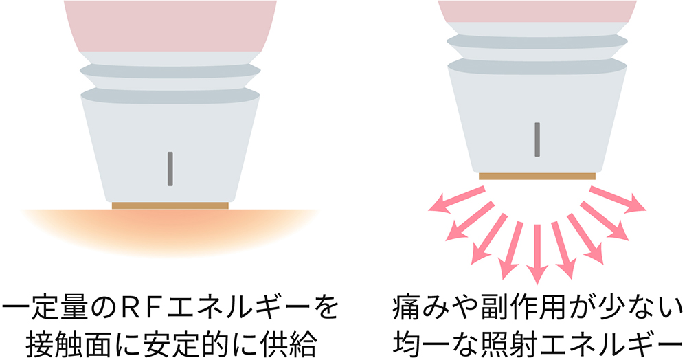 痛みが少ない