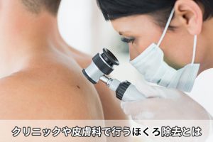 クリニックや皮膚科で行うほくろ除去とは