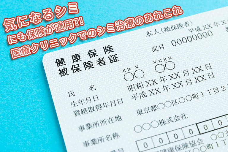 保険適用されるシミの種類は4種類。医師がシミの種類別で治療法を解説。