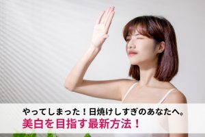 やってしまった！日焼けしすぎのあなたへ。美白を目指す最新方法！