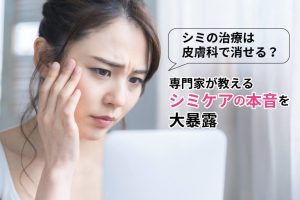 シミの治療は皮膚科で消せる？専門家が教えるシミケアの本音を大暴露