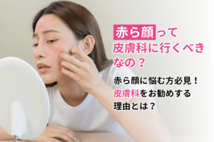 あからがおを皮膚科で治療すべき5つの理由❘保険適用治療もあり