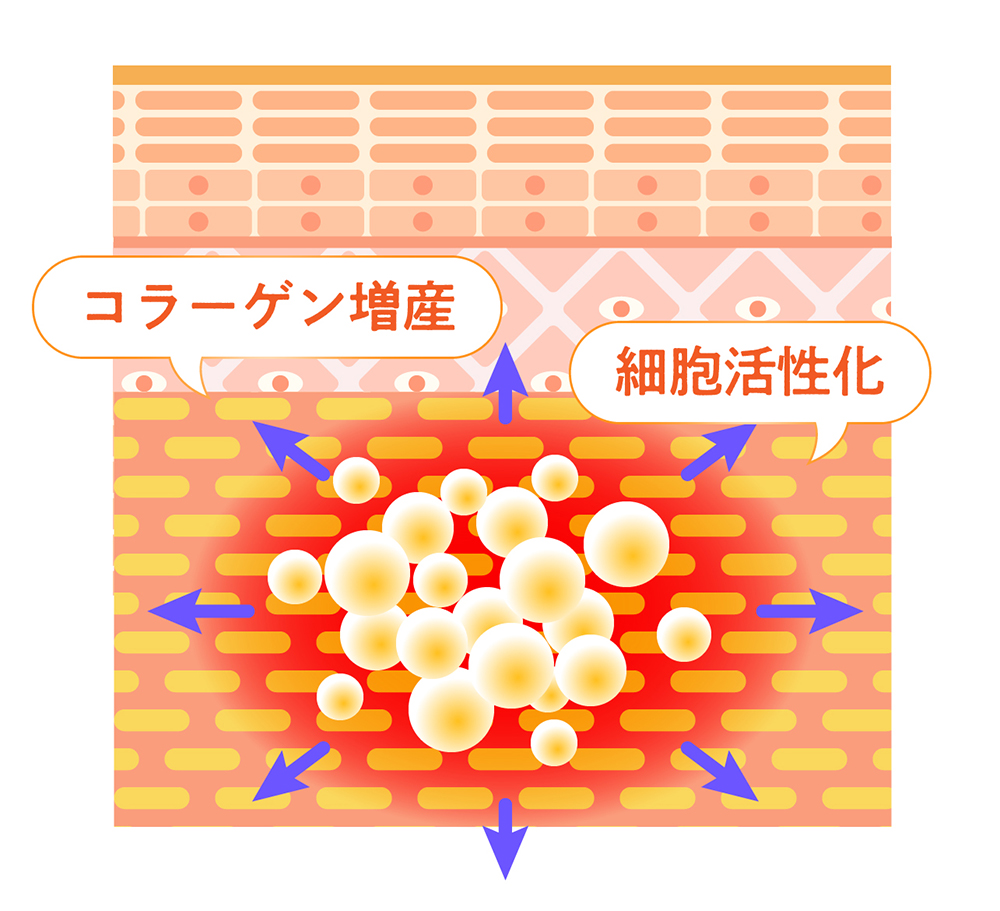 プロファイロの仕組み