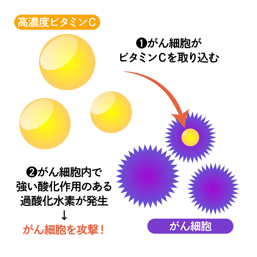 高濃度ビタミンCのがんへの効果