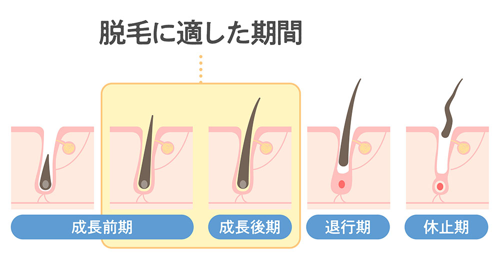 脱毛に適した期間