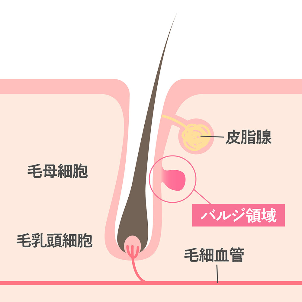 痛みが少ない機種を選ぶ