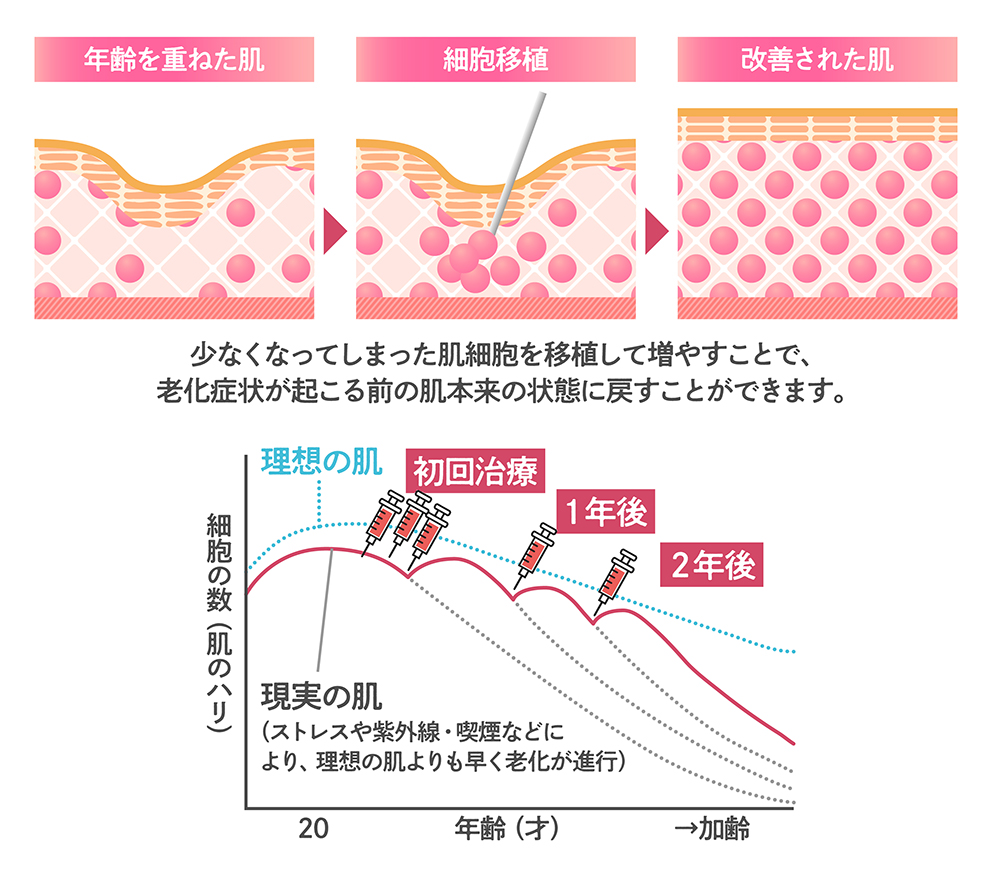 幹細胞治療