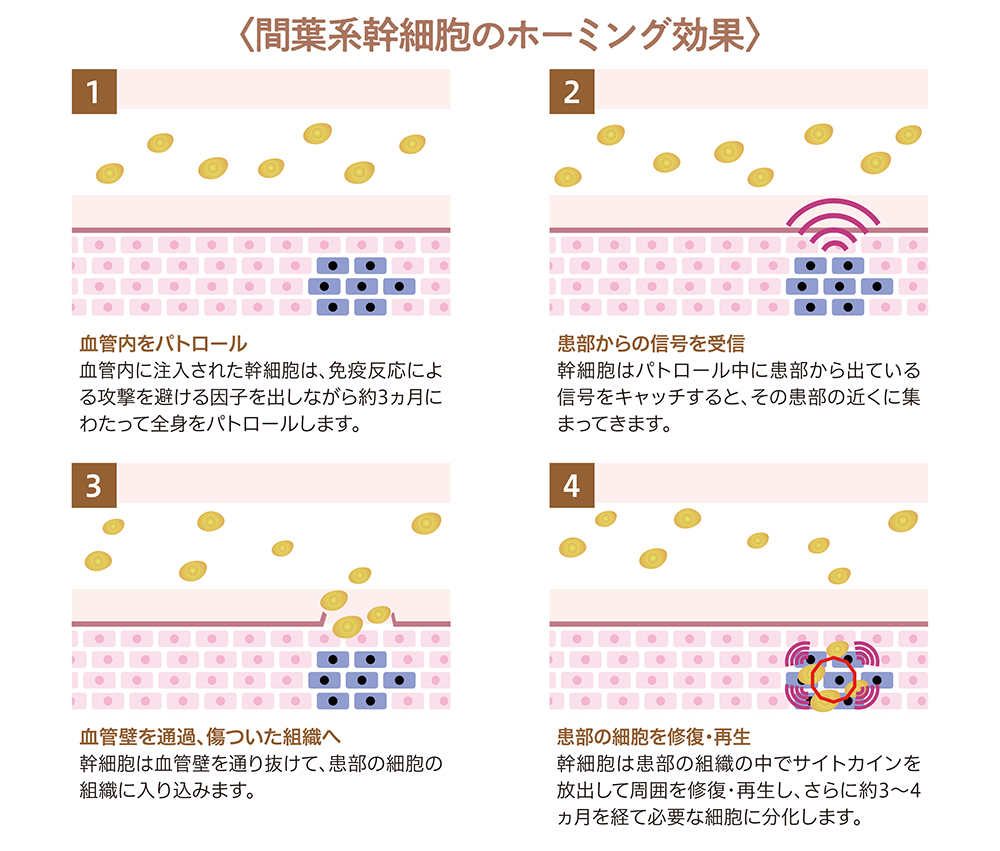 間葉系幹細胞のホーミング効果