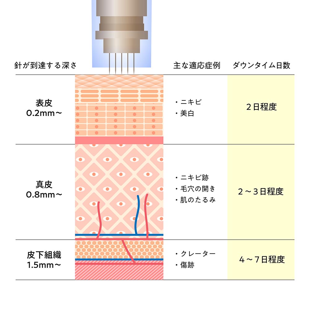 ダウンタイム日数の平均