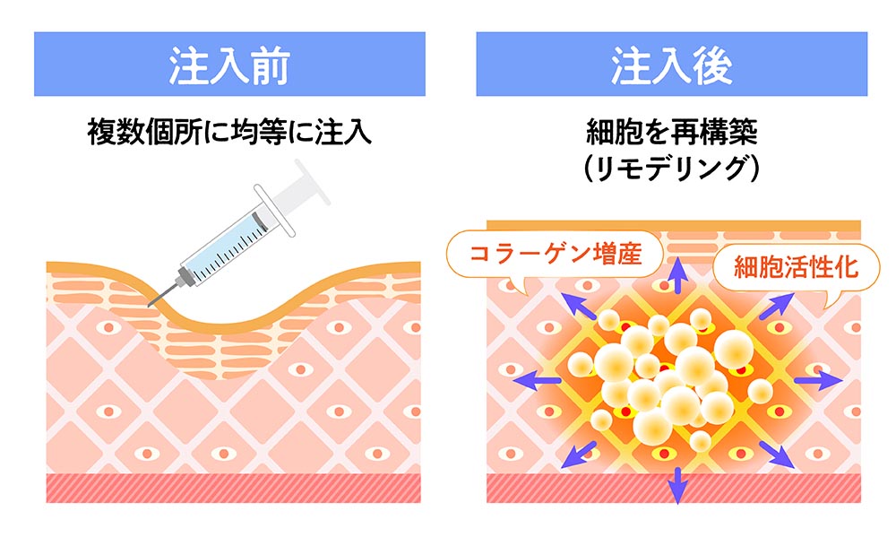 注射前・注射後