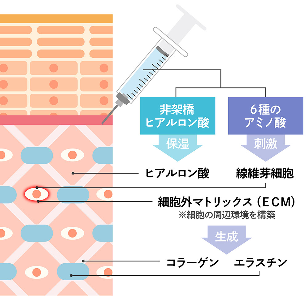 スネコス注射が毛穴に効果的なワケ