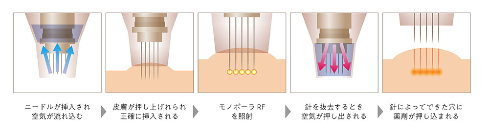 ポテンツァ