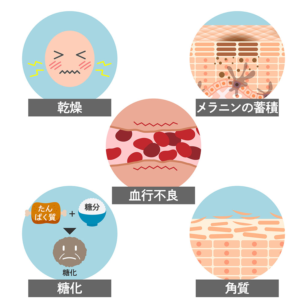 顔のくすみの原因は？種類別に解説