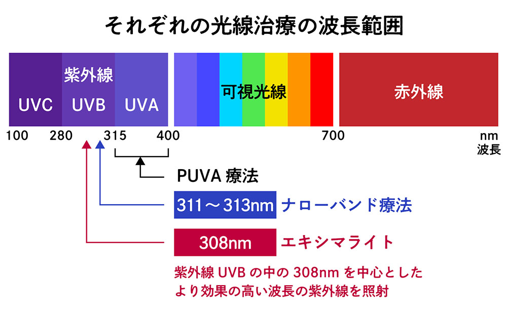 光線治療の波長範囲