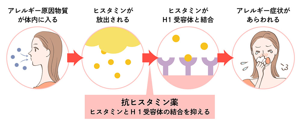 抗ヒスタミン薬で期待できる効果