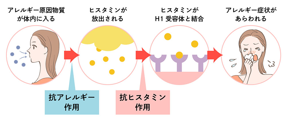 抗ヒスタミン薬とアレルギー薬の違い