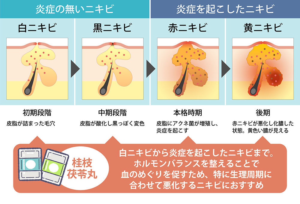 桂枝茯苓丸はどんな症状に効く？効果が出る時期は？