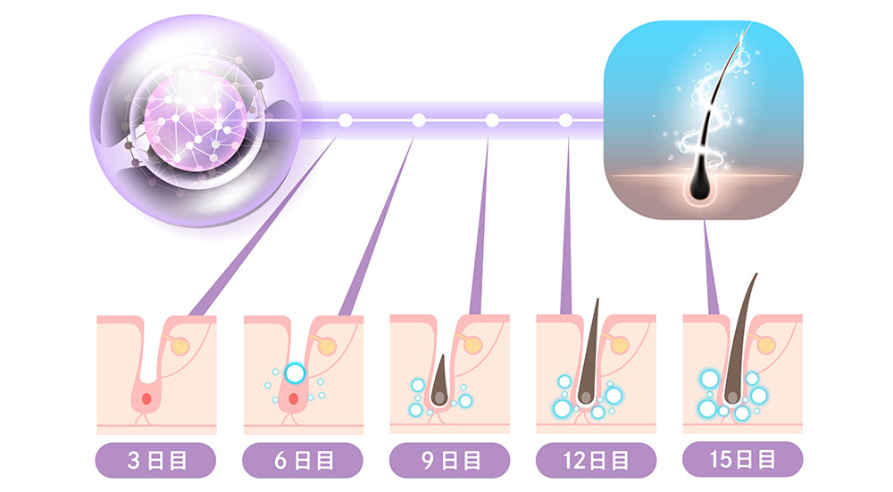 ヘアフィラーは最短2ヶ月で効果を実感