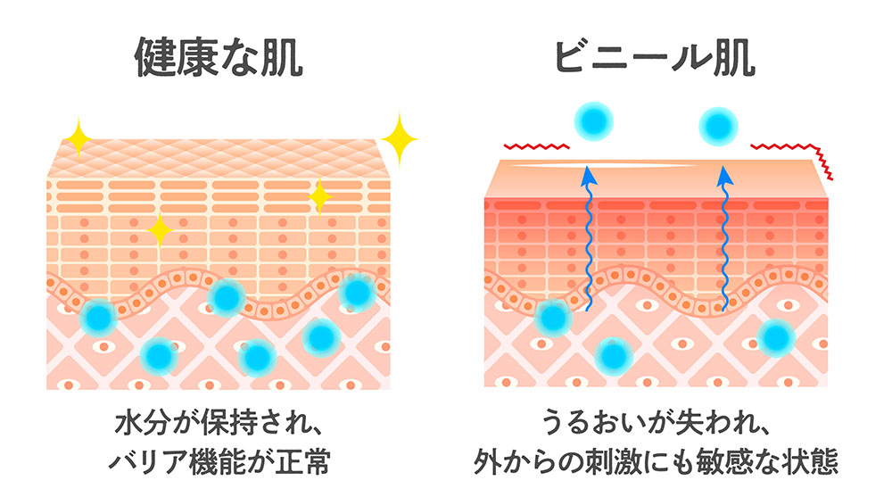 ビニール肌と健康な肌の違い