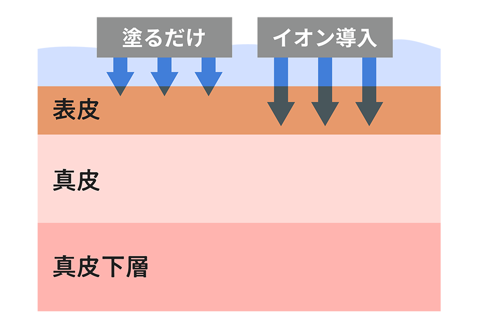 イオン導入とは