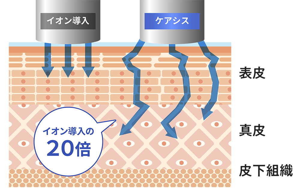 ケアシスとイオン導入の浸透力