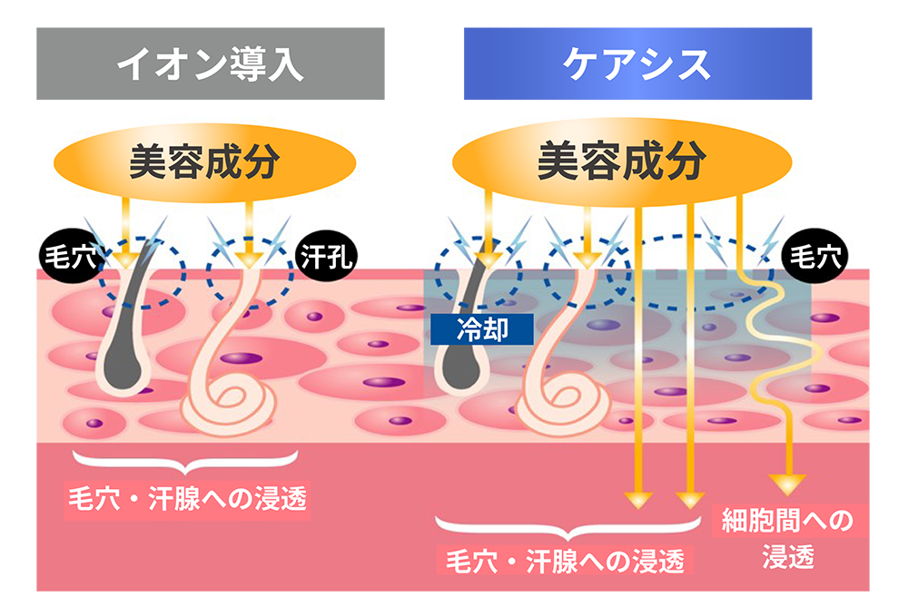 ケアシスの特徴