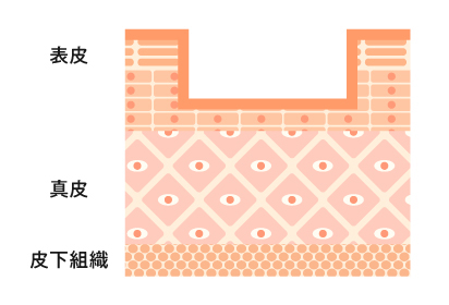 ボックスタイプイメージ図